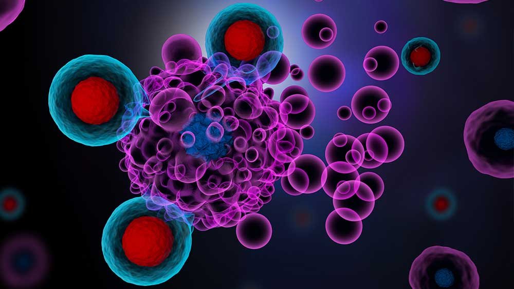 Diagnosi precoce dei tumori, quando l&rsquo;intelligenza artificiale diventa un sensore